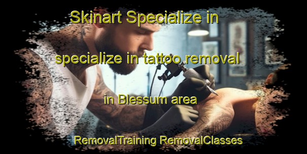 Skinart Specialize in specialize in tattoo removal in Blessum area | #RemovalTraining #RemovalClasses #SkinartTraining-Netherlands