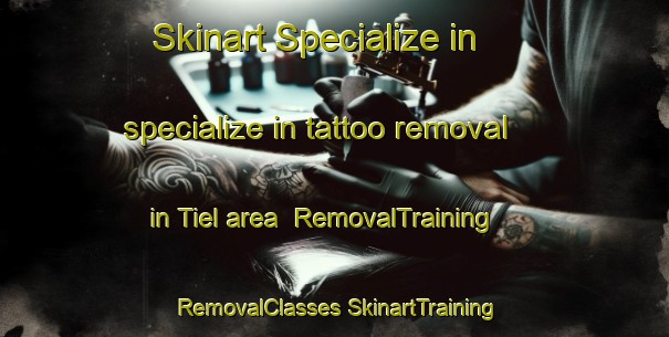 Skinart Specialize in specialize in tattoo removal in Tiel area | #RemovalTraining #RemovalClasses #SkinartTraining-Netherlands